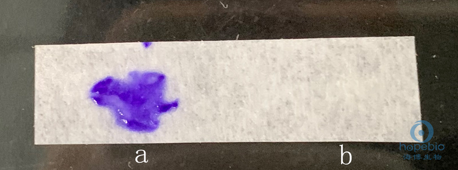 普通变形杆菌有哪些,为什么奇异变形杆菌那么难治