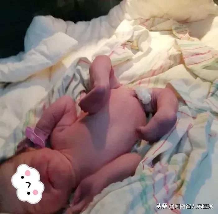 宝宝脚尖站立的原因,宝宝脚尖对脚尖走路怎么回事