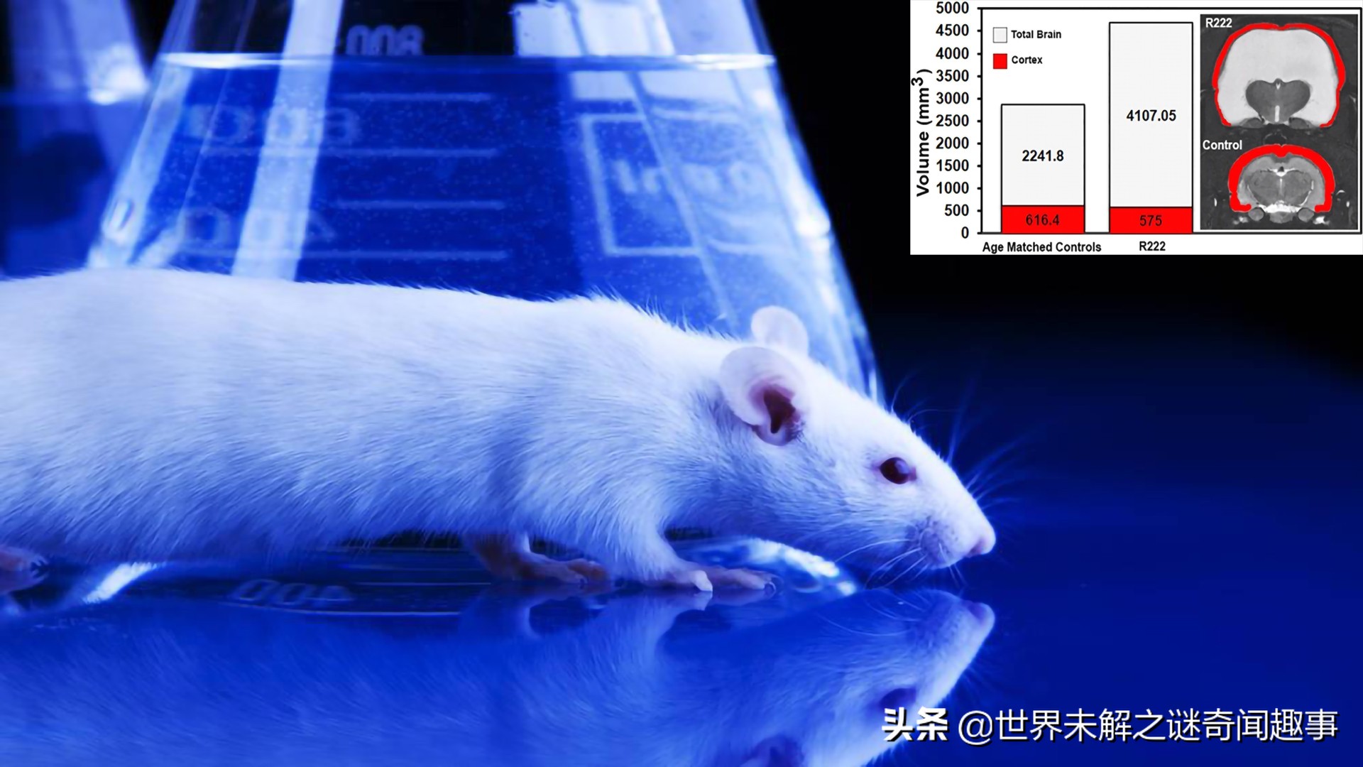 没有脑子还能活的动物,没有脑子的人存活的案例