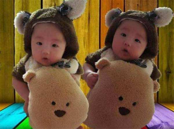 最美胎记，姐姐在胎中被弟弟“吸收”，将B超影像留在了弟弟腿上