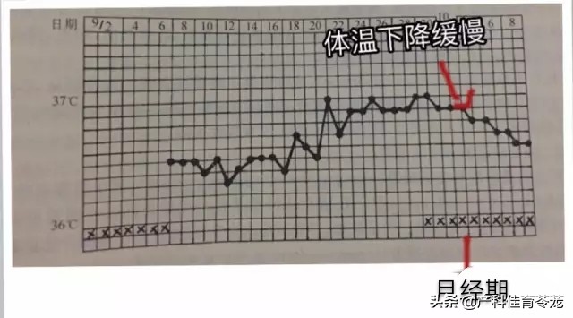 月经老不干净什么原因引起的,年龄50岁月经一直不干净