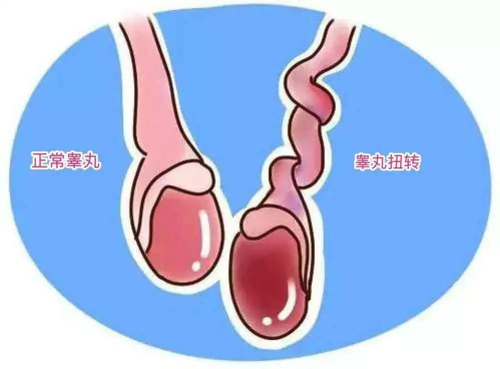 “蛋疼”真的不！能！忍！