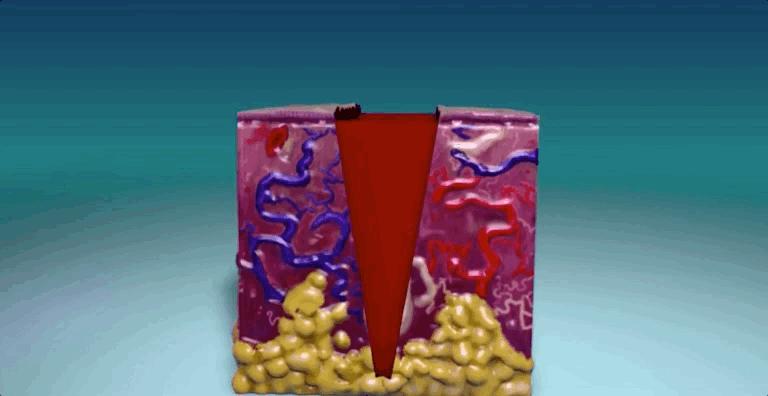 揭秘伤口如何愈合的,伤口是如何愈合的告诉小朋友