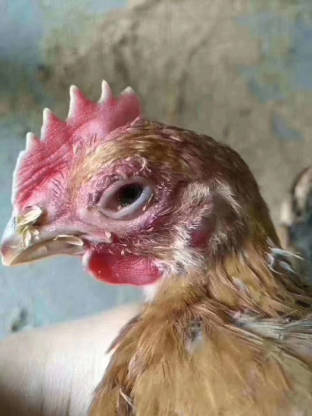 鸡眼睛长痘的最快治疗方法,人手上长鸡痘怎么治疗