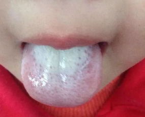 胃出血后的饮食补血,胃出血后调养期间食谱