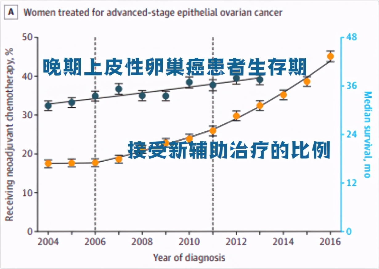 卵巢癌复发后，还能再次手术吗？一文带你了解