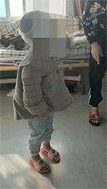 五岁的儿童发现两个特别大的肿瘤,2岁小孩脑部患罕见肿瘤