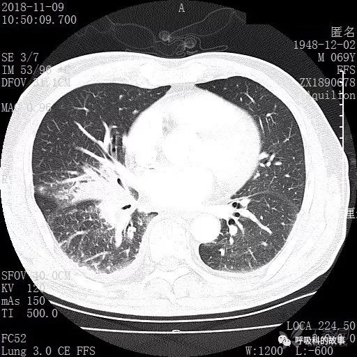 怎么应用统计学做调查,统计学方法可以解决的主要问题
