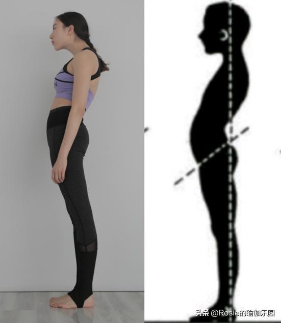 产后妈妈肋骨外翻外扩的危害,肋骨外翻是什么原因造成的女性