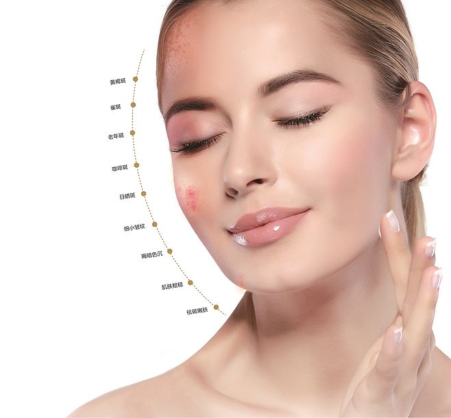 脸过敏发红发烫痒怎么快速止痒,脸过敏红肿发烫痛怎么快速恢复