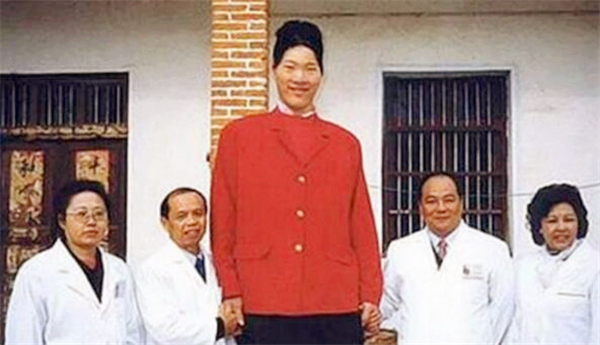 2.3米女巨人为什么去世,2米女巨人去世