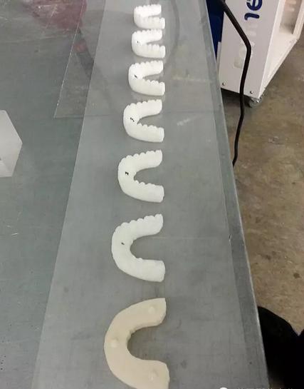 牙科隐形矫正器牙套制作,制作矫正牙套全过程