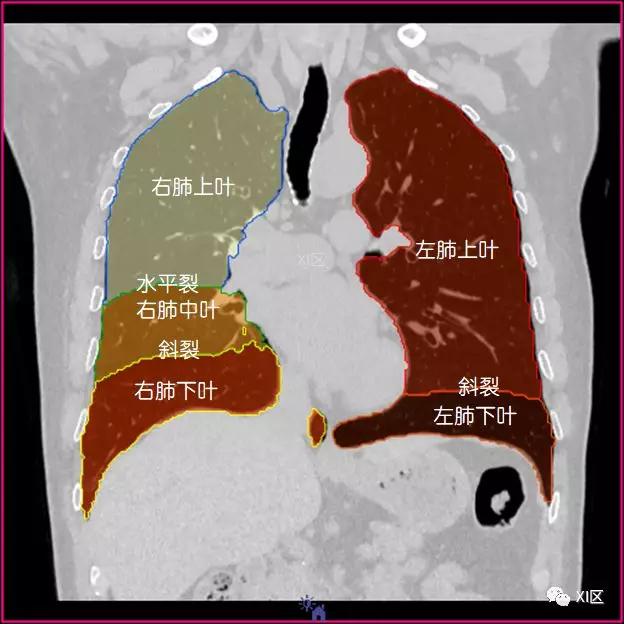 如此详细的肺部影像解剖，有点儿酷