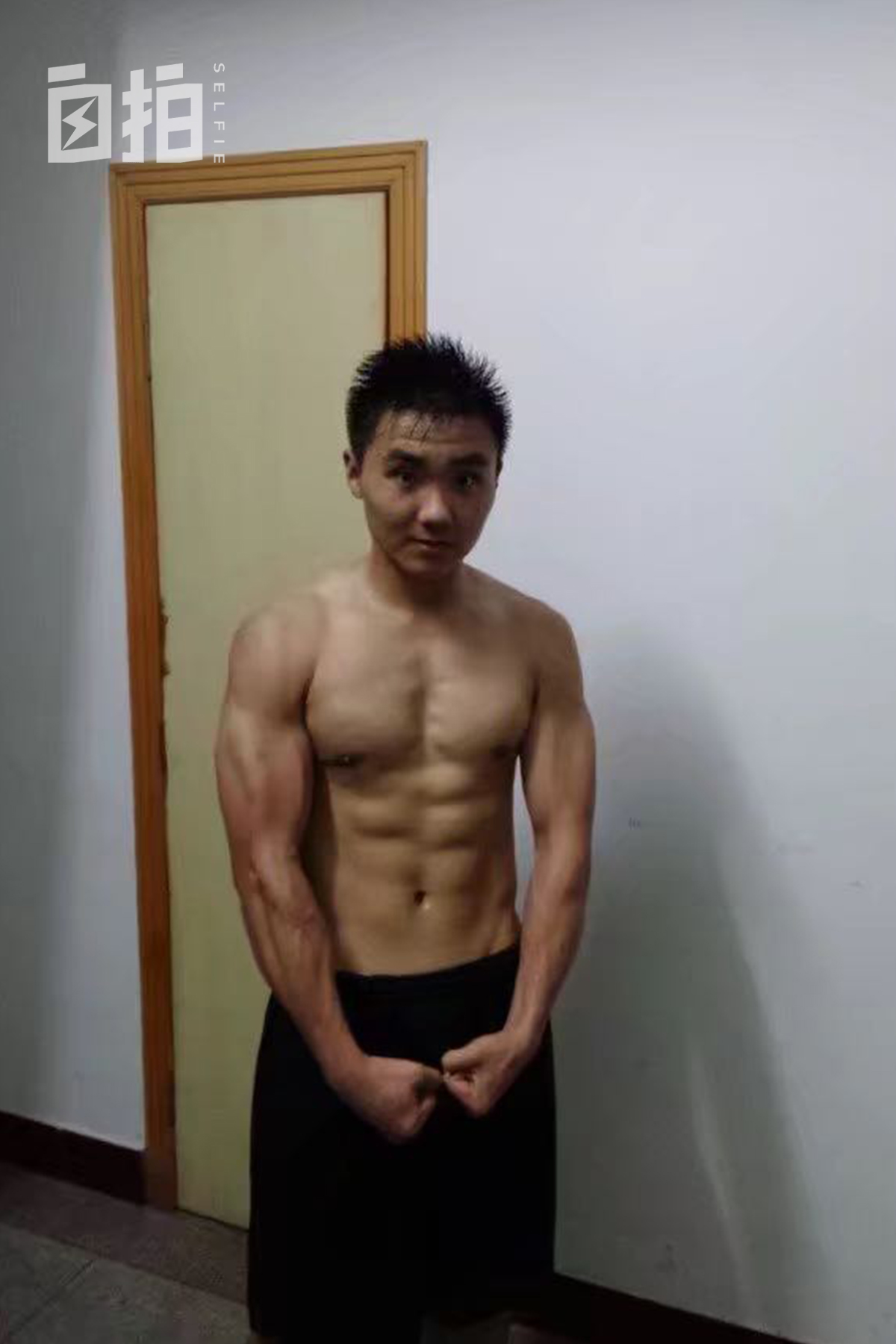 我27岁，在最幸福时与死神擦肩，涨成气球，女友仍不离不弃陪伴