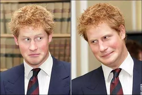 90后没有发际线,90后00后如何不脱发