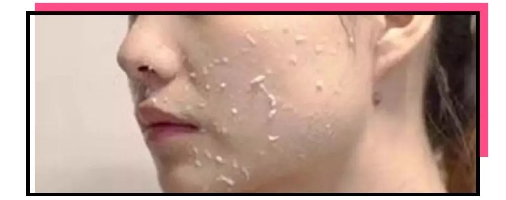 护肤品搓泥怎么救,护肤品搓泥怎么办