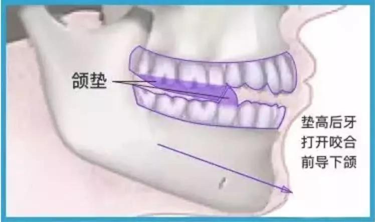 嘴突真的很影响颜值吗,被嘴凸影响的颜值