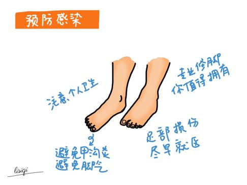 足部边缘反复起小水泡,足部起小水泡