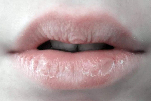 擦完口红嘴巴就起皮是怎么回事,怎样让嘴唇涂口红的时候不起皮