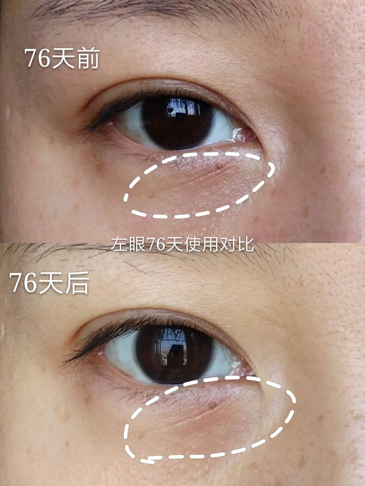 梵西六胜肽抗皱精华,薇娅梵西六胜肽精华液