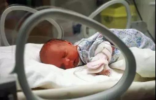 新生儿黄疸宝妈担心视频,新生儿黄疸护理和处理月嫂怎么做