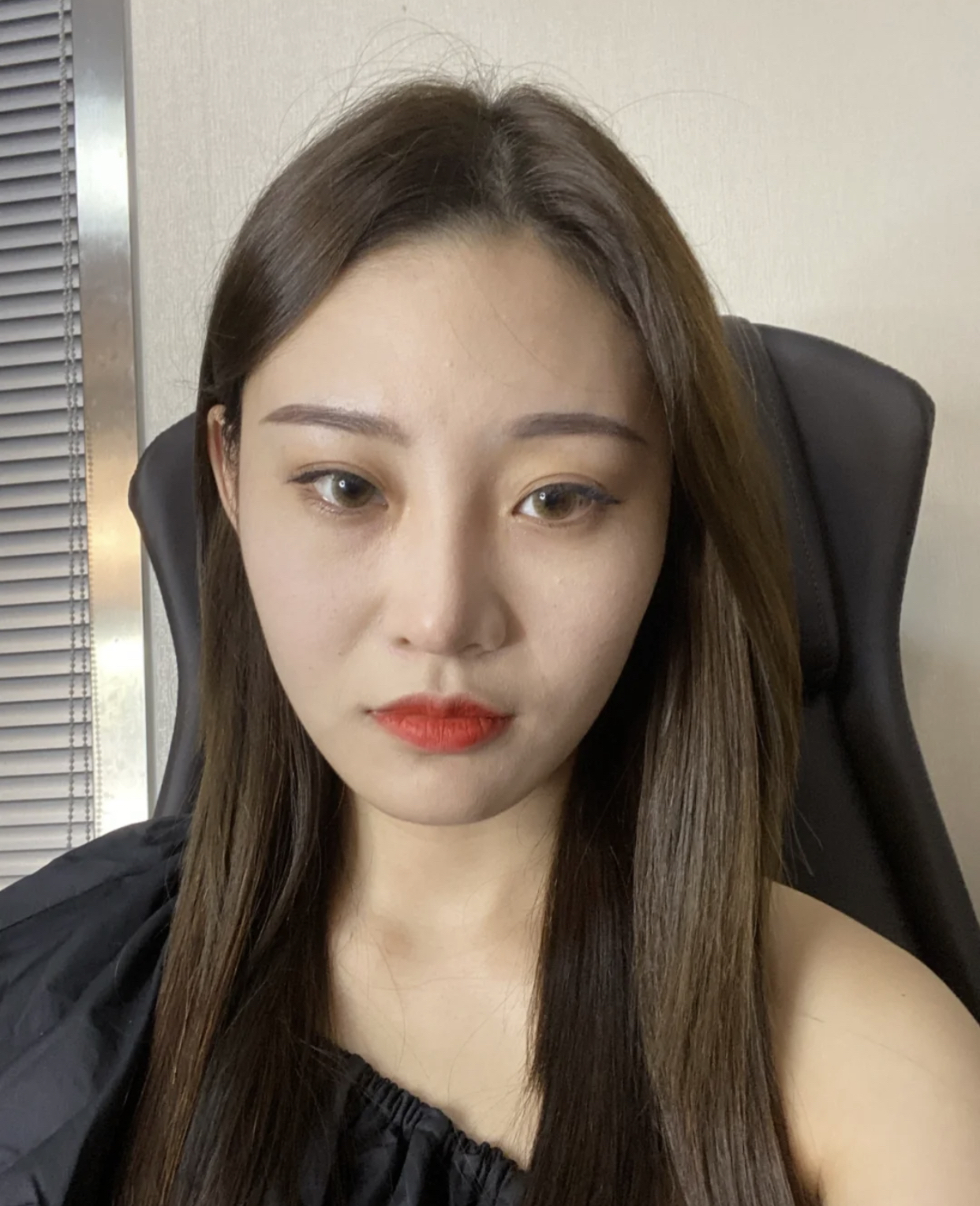 眼尾有皱纹怎么治疗,眼尾沟里面有皱纹怎么办