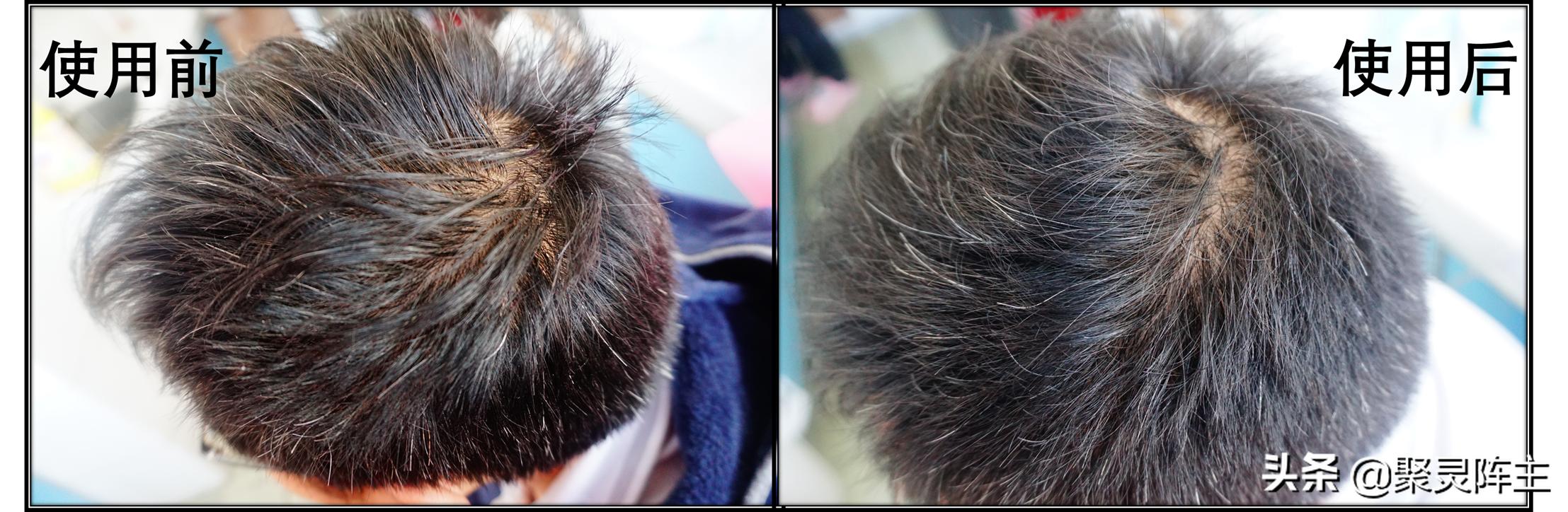 十款控油清洁产品推荐，不做中年油腻男