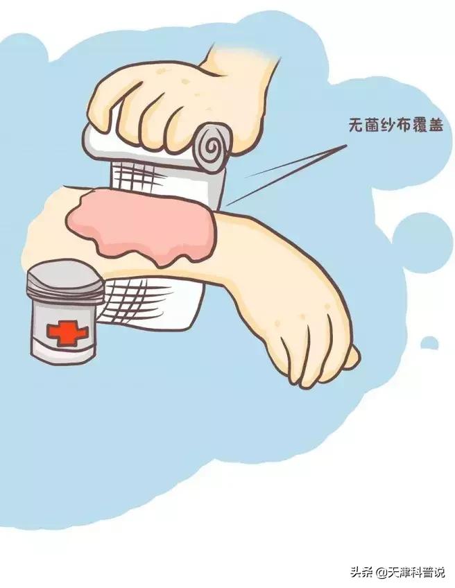 蛋清能治疗烫伤吗,蛋清能治疗老年斑吗