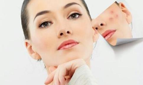 怎样祛痘印方法最有效,怎样祛痘印小妙招视频