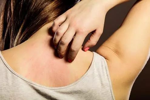 鍚冮敊鑽コ瀛╄倽琛扮,鍚冮敊鑽コ瀛╄倽琛扮鐜扮姸