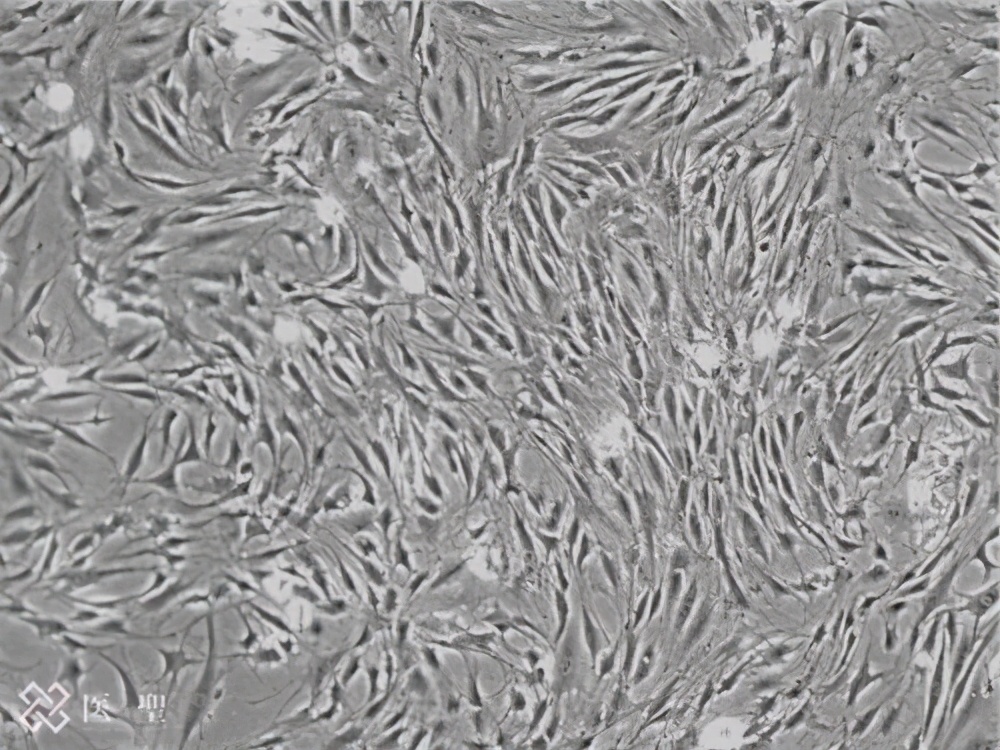 干细胞回输能治疗股骨头坏死吗,造血干细胞治疗股骨头坏死