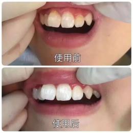 李湘贵妇,李湘美白牙膏