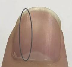 小小的指甲隐藏大大的健康秘密,小小指甲大调查