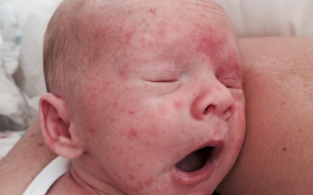 宝宝体重减轻了但不发烧,宝宝体重增加不明显