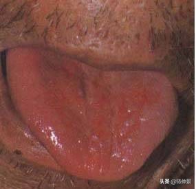 最实用的舌诊图六大舌象,舌诊深入学习书