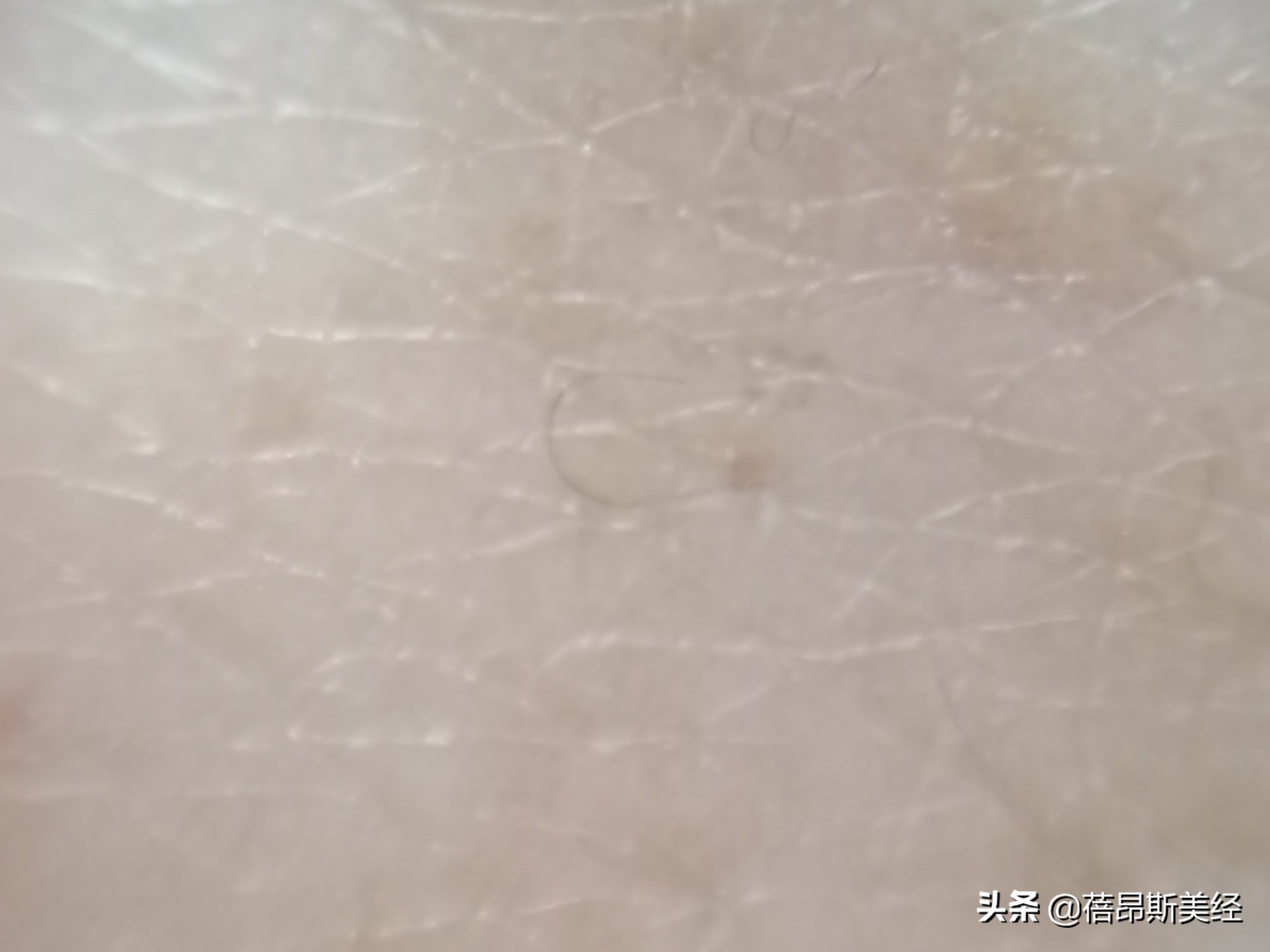 补水保湿神仙水哪个好用,神仙水哪款最适合敏感肌肤