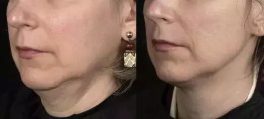 用简单的方法让脸变得更美,简单4个动作随时随地做让脸紧致