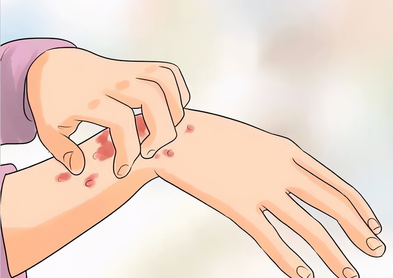 重点疾病防治有哪些,重点部位的预防控制措施