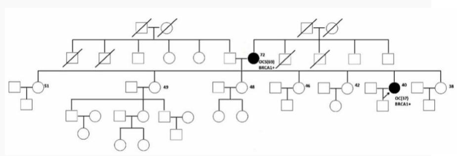 前列腺癌是怎么遗传的,前列腺癌的遗传特点是不完全外显