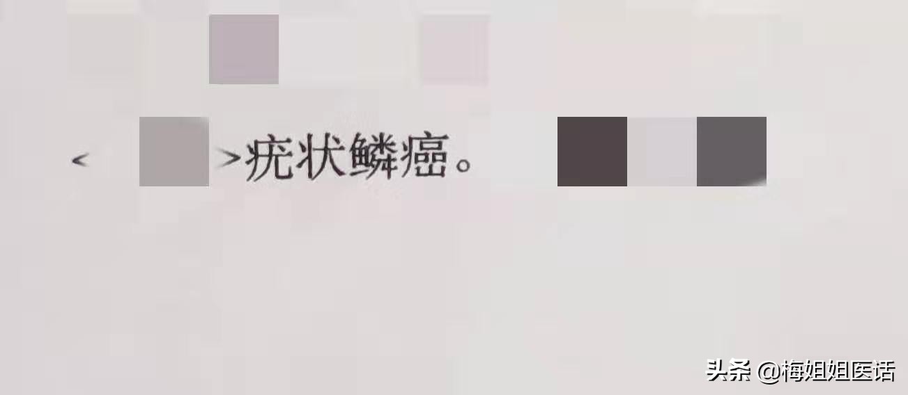 拒绝瘙痒,手皮疹越来越痒