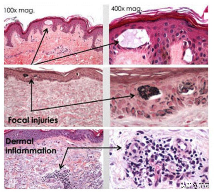 吴昕素颜真的很漂亮吗,吴昕为什么这么频繁上热搜