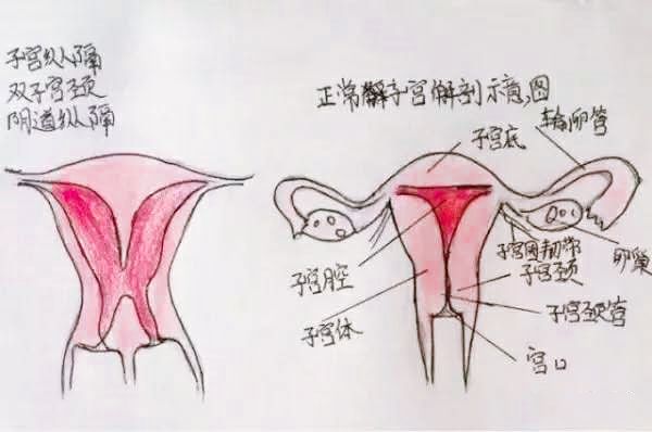 医生精美手绘图片大全,宫颈息肉红蓝铅笔手绘图