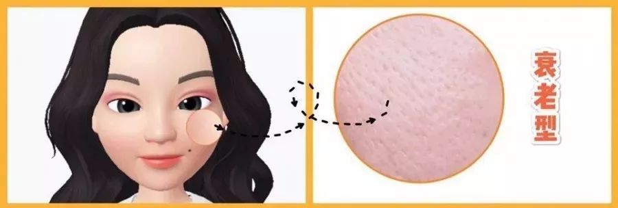 橘子皮怎么收缩毛孔,毛孔粗大橘子皮肤质还有救吗