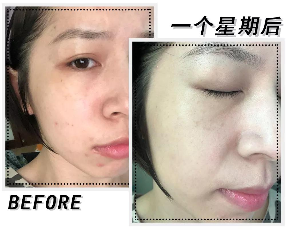 好用国货拯救肤色暗黄,熬夜脸黄暗沉用什么护肤品国货