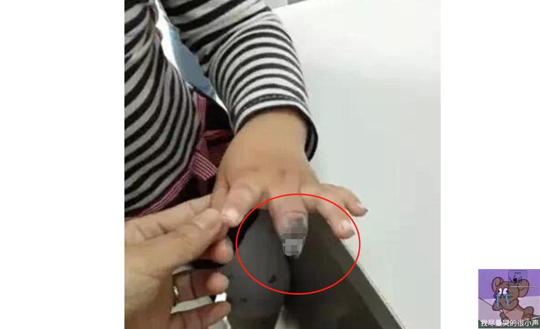 给孩子贴创可贴怎么不容易掉,小孩手受伤贴创可贴好还是不贴好