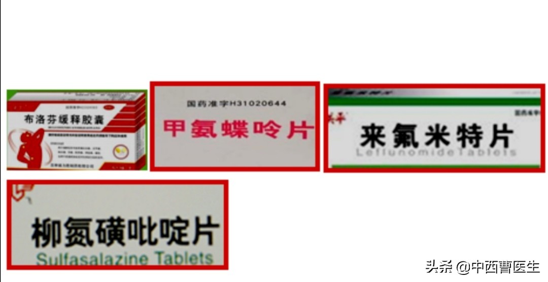 强直性脊柱炎的诊断和治疗,什么是强直性脊柱炎如何治疗