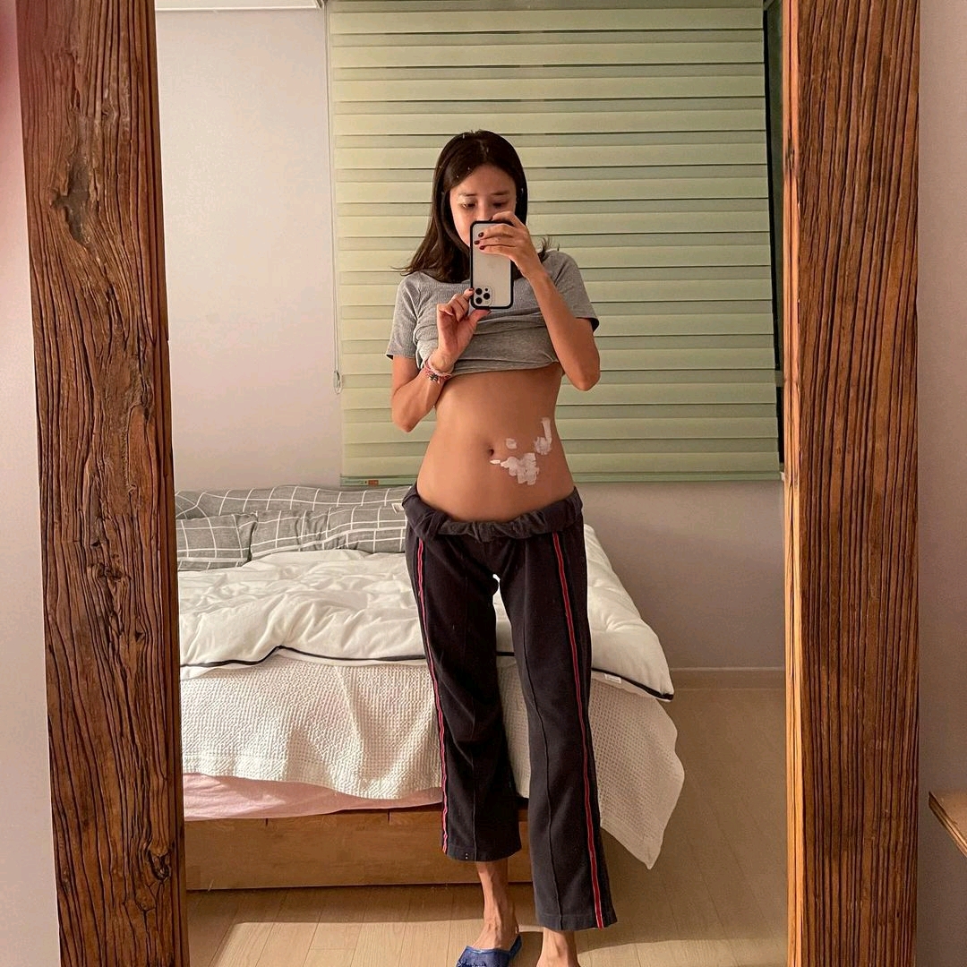 韩国女星肚子残留明显带状疱疹伤口,“失去感觉,必须治疗神经”