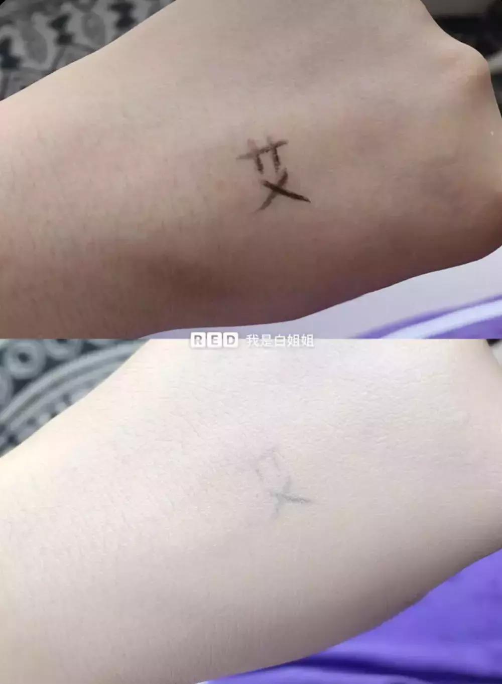 欧阳娜娜擦的药膏,欧阳娜娜擦什么药膏