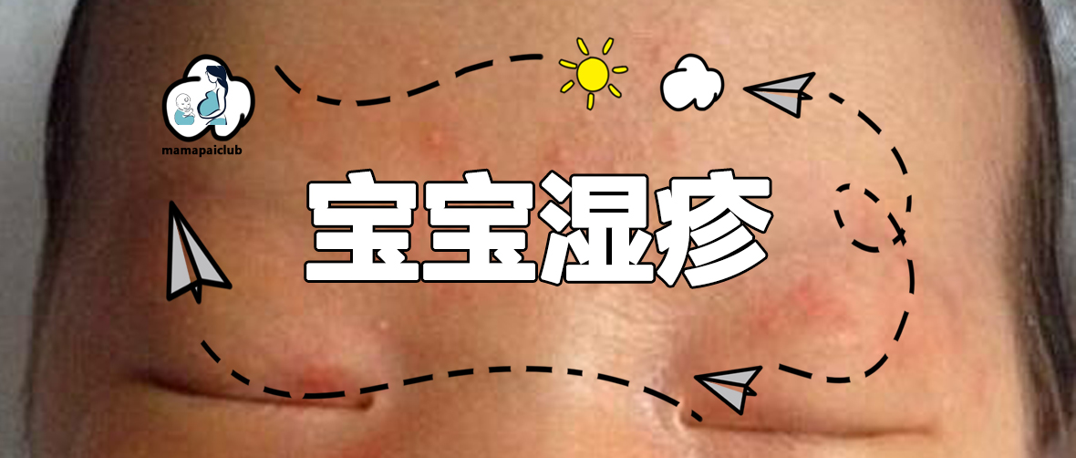新生儿热疹和湿疹的预防与护理,又到了过敏高发期