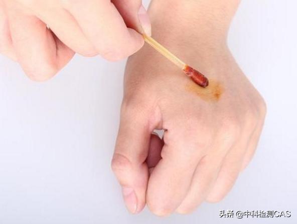 新生儿毒性红斑二十多天发作,新生儿毒性红斑严重用什么药